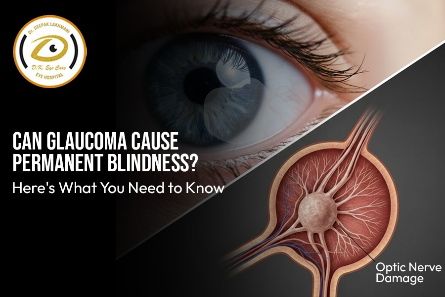 Can Glaucoma Cause Permanent Blindness? Everything You Need to Know | DK Eye Care